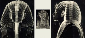 Φωτογραφία Ακτίνων-γ