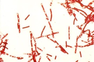 Μικροβιακή θεωρία