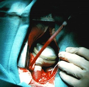 Μεταμοσχεύσεις